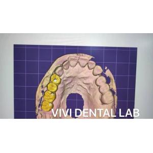 Full Contour Dental Crown Design Zirconia CE FDA Certified