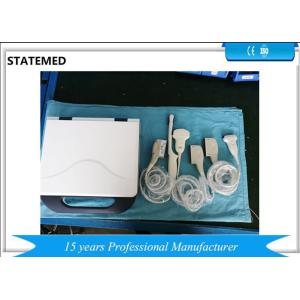 China Segmentos portáteis TGC do varredor 8 do ultrassom de Doppler da cor do portátil da gravidez supplier
