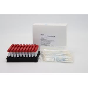 Virus Extraction Biological Sample Release Reagent Pharynx Swab PCR Clean Up Kit CE