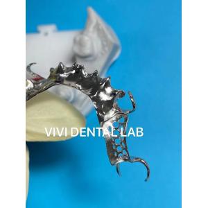 Printed Scheftner Metal Partial Denture Framework Accurate Customized