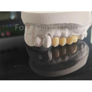 High Strength  Full Porcelain Layered Zirconia For Dental Crowns