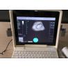 China 12 Inch LED Screen Portable Digital Ultrasound Scanner with All Kinds of Probes wholesale