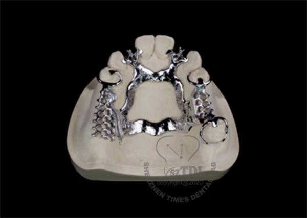 Argen Chrome Cobalt Removable Partial Denture Framework cast frame