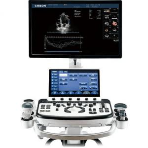 Cart-Based Chison Ultrasound Machine Xbit 90 With Auto EF Function