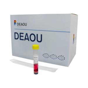 Latest Rapid Test Kit Rapid Diagnostic Kit Transport Medium Ce Certified