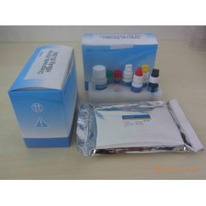 Ce Approved Hbsag Elisa Kit Medical Diagnostic Device