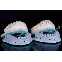 China Stain Resistant Dental Teeth Veneers Dental Clinic Veneers 0.3mm-0.5mm Thickness on sale