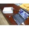 Mobile Ultrasound Machine Digital Laptop Ultrasound Scanner with 100 Frames