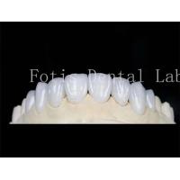 China Natural Color Dental Laminate Veneers Fake Teeth Veneers With Bonding Cement on sale