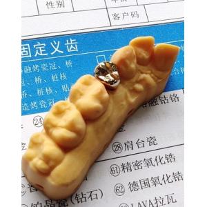 China Good Fitness High Precious Gold Alloy Dental Crown supplier
