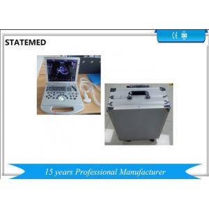 China Color Doppler Portable Ultrasound Scanner 128 E high Definition 3D 4D Notebook supplier