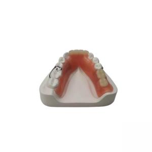 Flexible Resin Denture Dental Lab Dental Acrylic Removable Partial Dentures