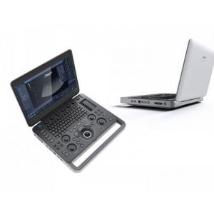 Smart Sight 500GB Laptop SonoScape Ultrasound Machine With 15.6'' LCD