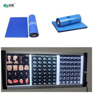 Blue Base Inkjet Medical X Ray Film 210 Micorn 10inch Roll 8x10 14x17 A4 A3 100 Sheets