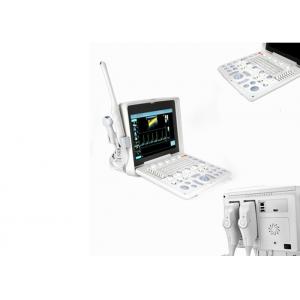 Full Digital Portable Color Ultrasound Scanner Economical Color Ultrasound Doppler With PW Function