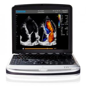 Easy To Carry 4D Chison SonoBook 9 Laptop Ultrasound Machine