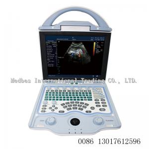 2 ultrasonic transducer Portable3D Color doppler ltrasound Scanner  portable ultrasound machine for pregnancy