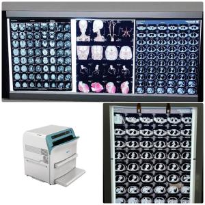 China Low Fog Medical X Ray Film With 320dpi Resolution 14 x 17 on Led X Ray Film View Box supplier