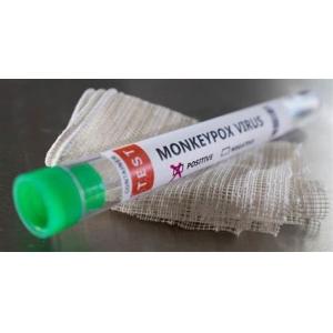 Monkeypox Virus Detection Reagent Real Time PCR Kit