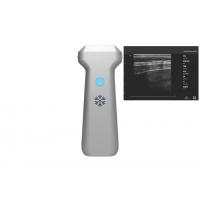 China Linear Probe Wireless Portable Ultrasound Machine 32 Channel on sale