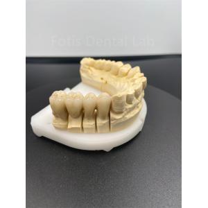 Good Performance Dental Zirconia Multilayer The Ultimate Ceramic Solution