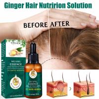 Ginger Hair Growth Essence Germinal Hair Growth Serum Essence Oil Hair Loss Treatment Growth Hair for Men Women
