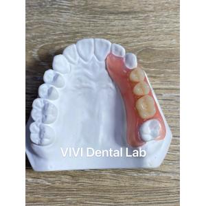 High Esthetics Flexible Acrylic Partial Denture / Valplast Dental Partials