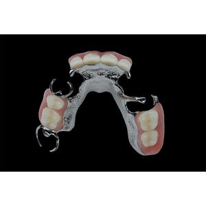 China Customizable Removable Dentures Titanium Framework Dental Metal Framework wholesale