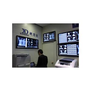China Película de X Ray de Digitaces de la transparencia, proyección de imagen médica AGFA/película seca de Fuji X Ray supplier