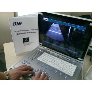China PC Based B / W Portable Ultrasound Scanner 15 inch Laptop Screen Only 5kgs Weight Convenient to Carry supplier
