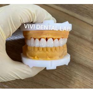 CE Dental Tooth Crowns Nickel Beryllium Free VIVI Dental Laboratory