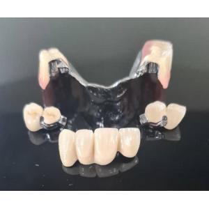 China Metal Framework Precision Attachment Overdenture Removable Tooth Denture wholesale