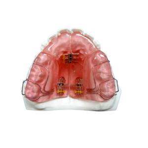 China Custom Removable OEM Fixed Orthodontic Appliance Good Durability supplier