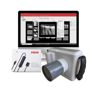 Dental Radiology Digital X Ray Equipment Maquina Equipo De Rayos X Portatil