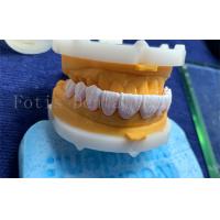 China Advanced Digital Dental Crowns Implant Dentrue Crown FDA/ISO/CE Certified on sale