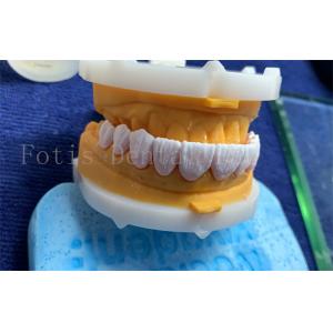 Advanced Digital Dental Crowns Implant Dentrue Crown FDA/ISO/CE Certified