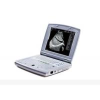 China Portable Baby Ultrasound Machine Portable Ultrasound Scanner for Pediatrics on sale