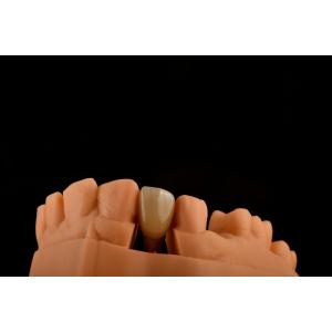 China 内部ヘックス3.0mm 深さ1.5mmピッチ シングルチタン歯科インプラント 交換 wholesale