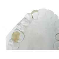 China Durable Flexible PFM Bridge Crown Dental IPS E Max Press Inlay Onlay on sale