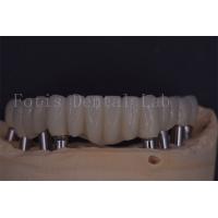 China Reliable Dental Implant Crowns For Comfort And Functionality on sale
