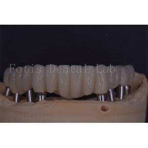 Reliable Dental Implant Crowns For Comfort And Functionality