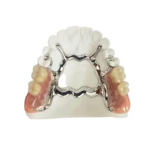 Natrural Shade 3D Printing Fixed Removable Denture For Dentist Study
