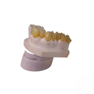 China CAD CAM Design PFM Dental Crown Laboratory 3D Printer Dental Crowns supplier