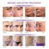 China New Design 7d Ultralift 360 Pain less Hifu Face Lifting System Weinkle Removal Smas Body Weight Loss Vmax Skin Lifting Slim Machine Factory Supply wholesale
