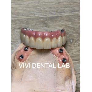 Nickel Beryllium Free Dental Implant Crown Esthetic Full Implant Bridge