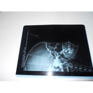 China KND-A Environment friendly Medical Dry Imaging Film For X Ray Examination On AGFA 5300 supplier