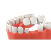 China OEM Dental Crown Bridge Good Biocompatibility Smooth Surface Make Smile Sweeter on sale