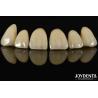 China Bionic Development Leaves And Distinct Layers Of Zirconia All-Ceramic wholesale