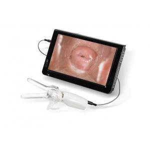 China Mini Colposcope for Cervical Examintion Vaginal Camera Connected to TV or PC supplier