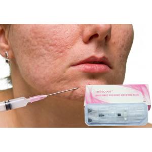China 1ml Sodium Hyaluronate Gel Injection For Removing Fine Facial Wrinkles supplier